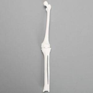 Knee, Pediatric, Solid White Plastic