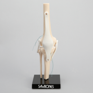 Knee ACLR Demonstrator with Removable Bone Graft