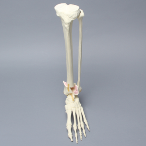 Foot and Ankle with Four-Part Tibial Pilon Fracture