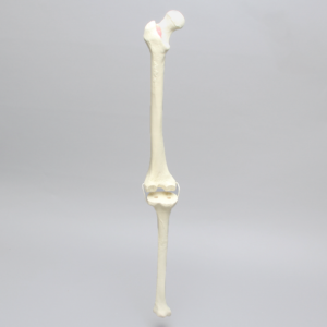 Knee with Revision Cuts and Non-Stretch Collateral Ligaments, Full Length