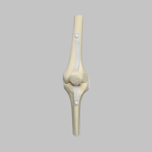 Knee Joint with Patella and Four Non-Stretch Ligaments, Solid Foam, Medium