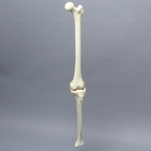 Knee with Narrow Intercondylar Notch and Three Long Stretch Tube Ligaments, Full Length