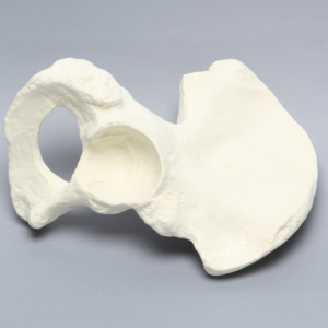 Hemi Pelvis with 57mm Acetabulum, Foam Cortical, Right
