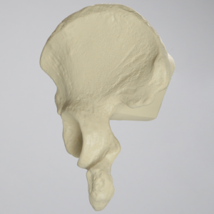 Hemi Pelvis, High-Density, Solid Foam, Left