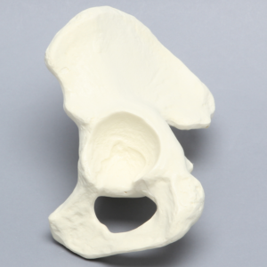 Hemi Pelvis with Reinforced Acetabulum, Solid Foam, Left