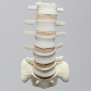 Spine, Lumbar with Tan Discs and Single Ligament, Solid Foam