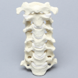 Spine, Cervical with Posterior Ligament and White Discs, Solid Foam