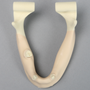 Mandible with Mucosa, Partially Edentulous