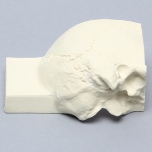 Skull, Posterolateral Quarter Section