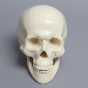 Skull, Full, With Le Fort I, Orbital, Zygomatic, and Mandibular Fractures