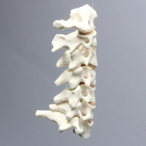 Spine, Cervical, Posterior Ligament, Solid Foam