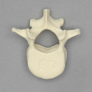 Vertebra, L3, Pediatric, Solid Foam