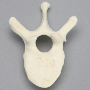 Vertebra, T10, Foam Cortical