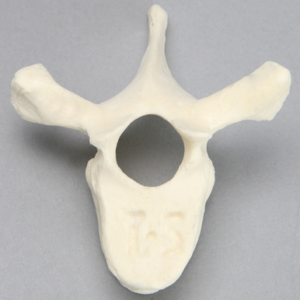 Vertebra, T5, Foam Cortical
