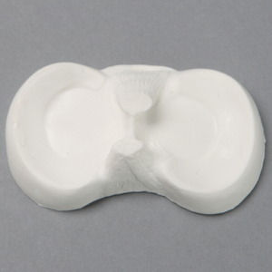 Meniscal Puck with Reinforcement