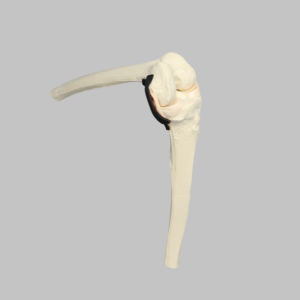 Knee Insert, Encapsulated ACL, Large