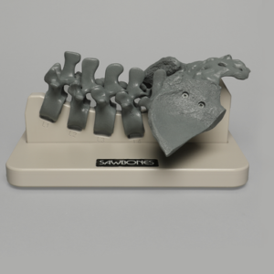 Lumbar Spinal Navigation Set