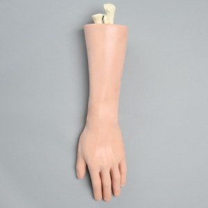 Hand and Wrist with Midshaft Fractures, Encased