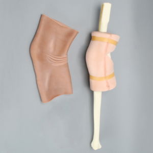 Knee without Clamps, Arthroscopy