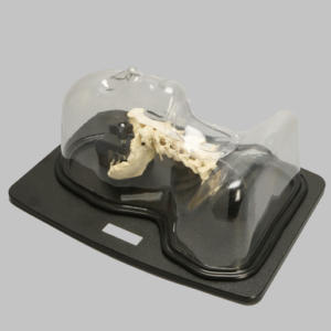 Cervical Holder for Anterior Approach Procedures