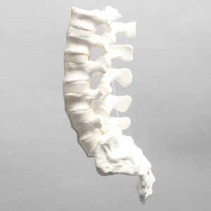 Lumbar Vertebrae with Pedicle Tunnels, L1-Sacrum
