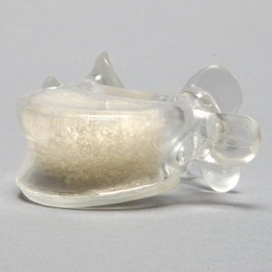 Vertebra L5 with Open Cell Cancellous, Solid Clear Plastic