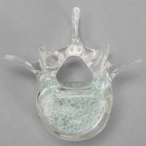 Vertebra L4 with Open Cell Cancellous, Solid Clear Plastic