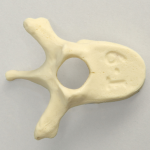 Vertebra, T9, Foam Cortical