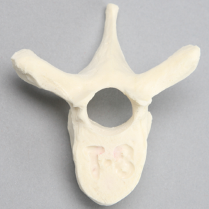 Vertebra, T8, Foam Cortical