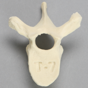 Vertebra, T7, Foam Cortical