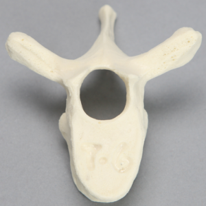 Vertebra, T6, Foam Cortical