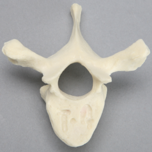 Vertebra, T4, Foam Cortical