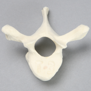 Vertebra, T3, Foam Cortical