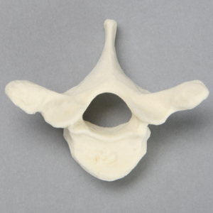 Vertebra, T2, Foam Cortical
