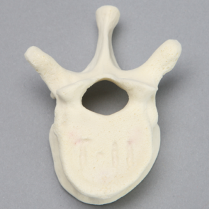 Vertebra, T11, Foam Cortical
