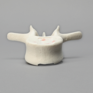 Vertebra, L3, Foam Cortical Shell, For Spinal Navigation