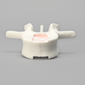 Vertebra, L2, Foam Cortical Shell, For Spinal Navigation