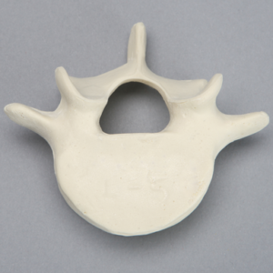 Vertebra, L5, Foam Cortical