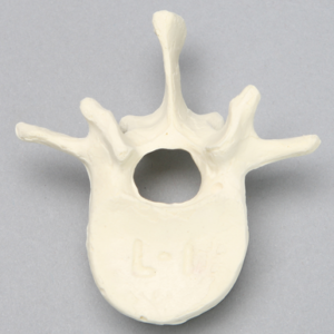 Vertebra, L1, Foam Cortical