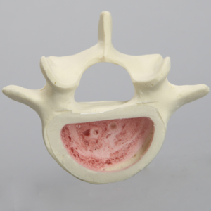 Vertebra, L5, Clear Window, Foam Cortical