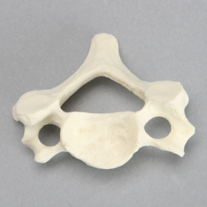 Vertebra, C5, Solid Foam
