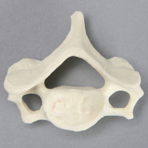 Vertebra, C6, Foam Cortical