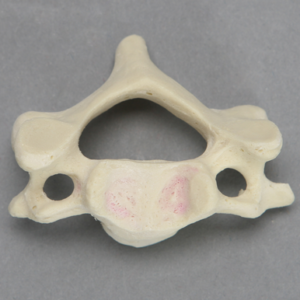Vertebra, C4, Foam Cortical