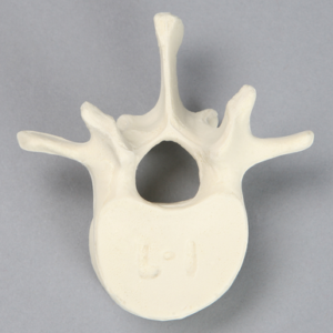 Vertebra, L1, Solid Foam