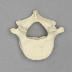 Vertebra, L5, Pediatric, Solid Foam