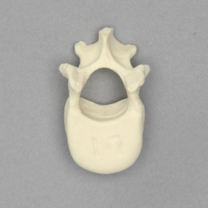 Vertebra, L1, Pediatric, Solid Foam