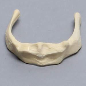 Hyoid Bone, Component of Palate/Tongue Complex