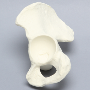 Hemi Pelvis with 64 mm Acetabulum, Solid Foam, Left