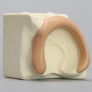 Acetabulum on Block with Labrum, Solid Foam, Left