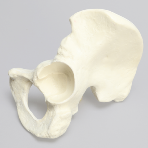 Hemi Pelvis with 57mm Acetabulum, Foam Cortical, Left